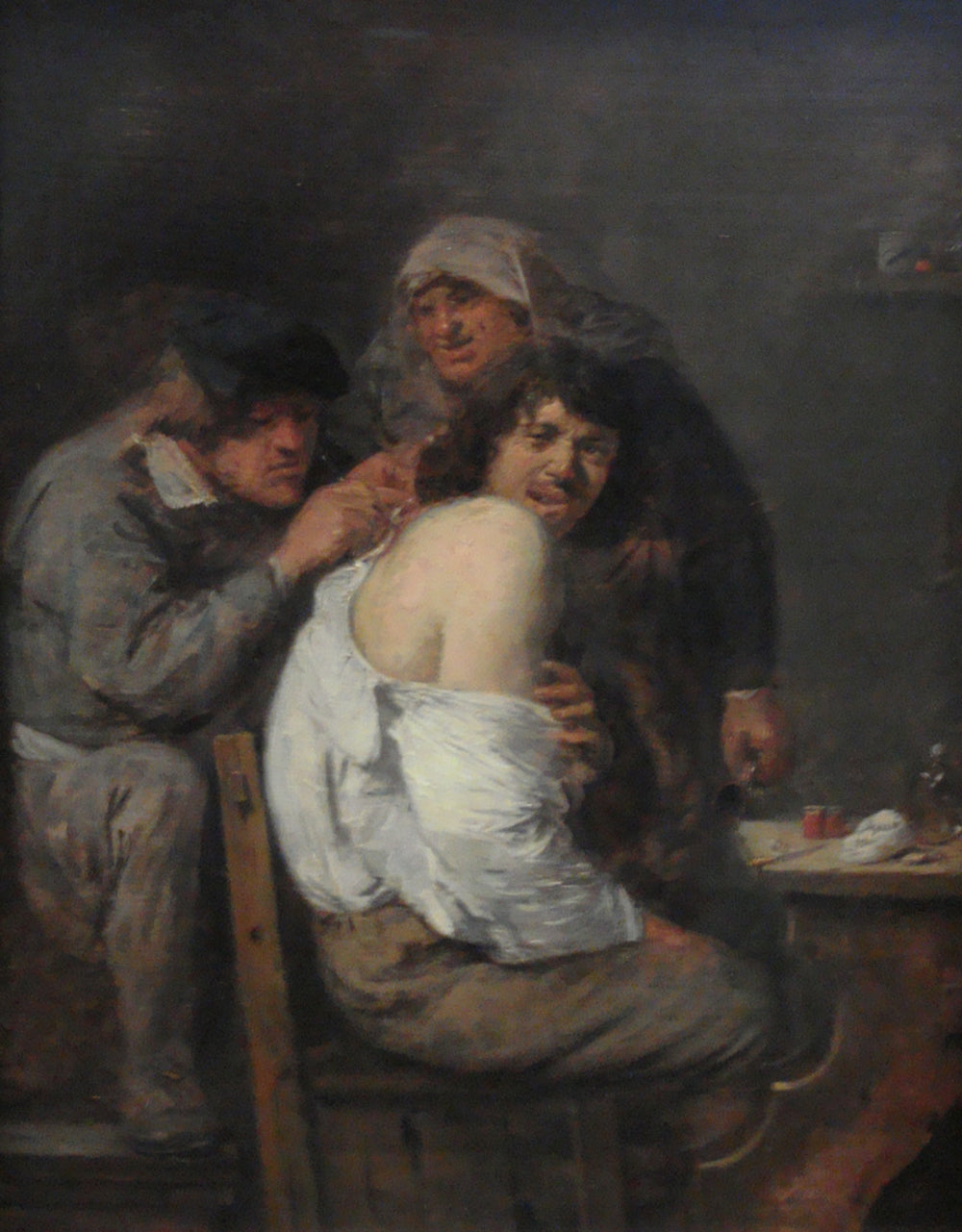 L'opération du dos - Adriaen Brouwer image 1 reproduction de peinture à l’huile